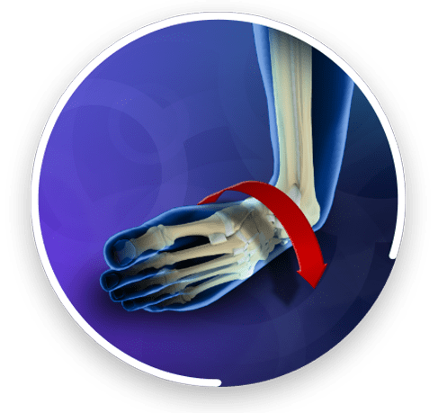 Ankle Instability