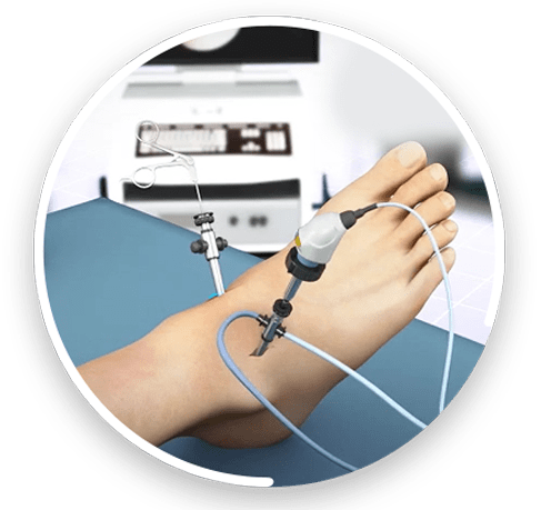 Minimally Invasive Surgery